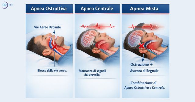 Le Apnee Notturne e i Disturbi Respiratori del Sonno - Tipi, Sintomi, Terapie e Conseguenze